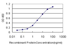 IHC-plus™ GOLM1 / GP73 / GOLPH2 Antibody (clone 5B10)