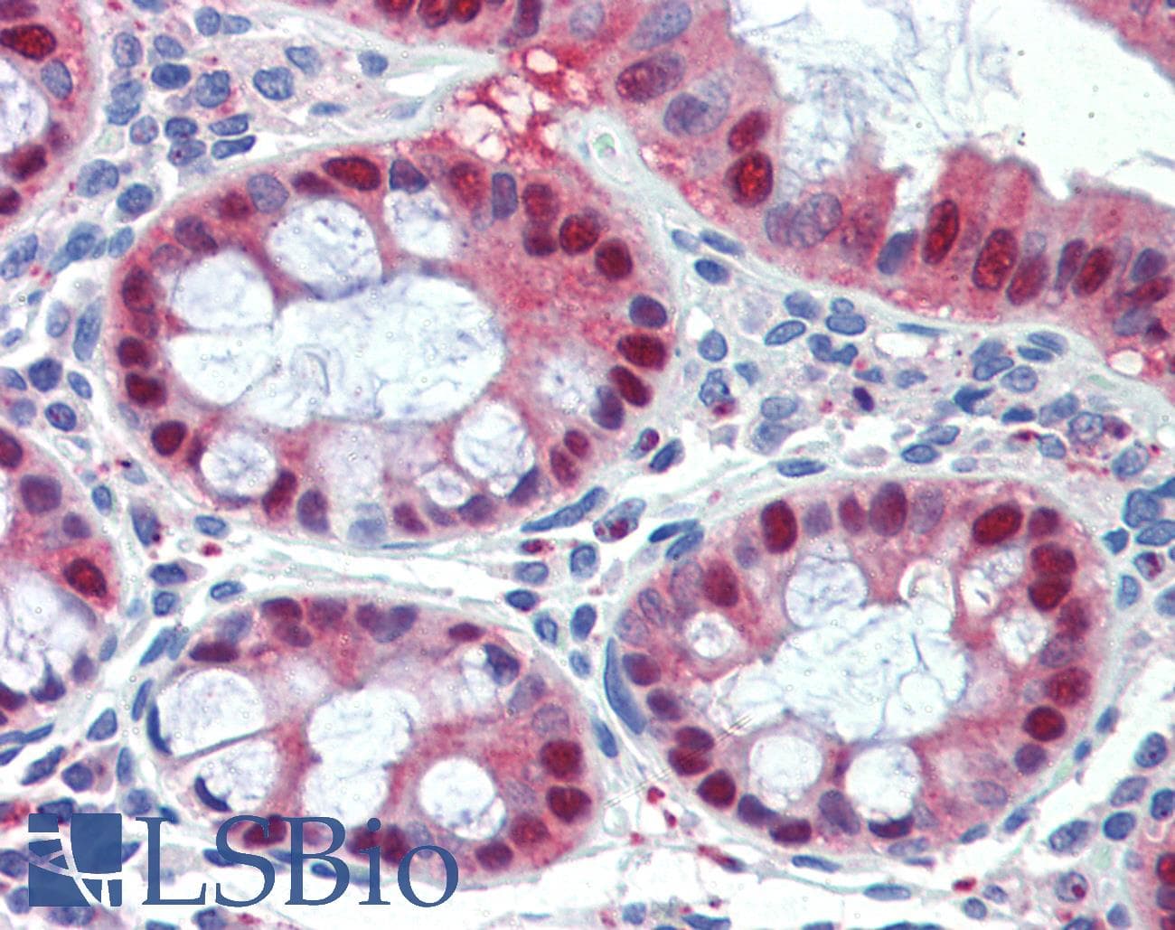 SCML1 Antibody (aa108-157)