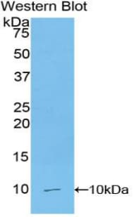 CCL5 / RANTES Antibody (aa24-91)