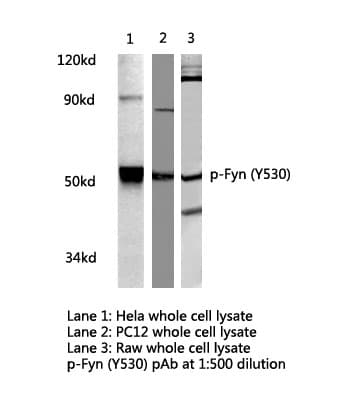 SYN / FYN Antibody (phospho-Tyr530)