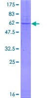 Human CA5A / Carbonic Anhydrase VA Protein (Recombinant GST)