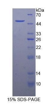 Mouse GAS6 Protein (Recombinant His-GST)