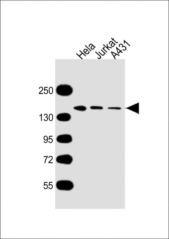 Monoclonal Mouse anti-Human MYBBP1A Antibody (clone 1702CT711.87.46, WB)
