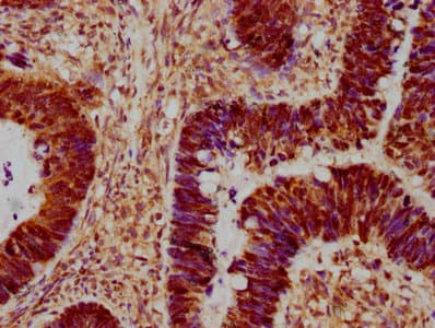 Polyclonal Rabbit anti-Human MAPK14 / p38 Antibody (IHC, IF)