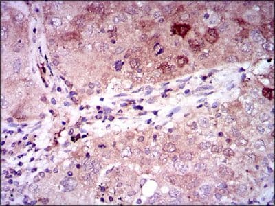 ENO2 / NSE Antibody (Amino Acid: 251-433, clone 5D3)
