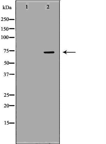 TBRG4 Antibody