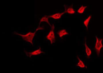 Polyclonal Rabbit anti-Human BCAR1 / p130Cas Antibody (IHC, IF, WB)