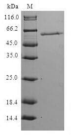Human HPS / HPS1 Protein (Recombinant GST, N-terminus)