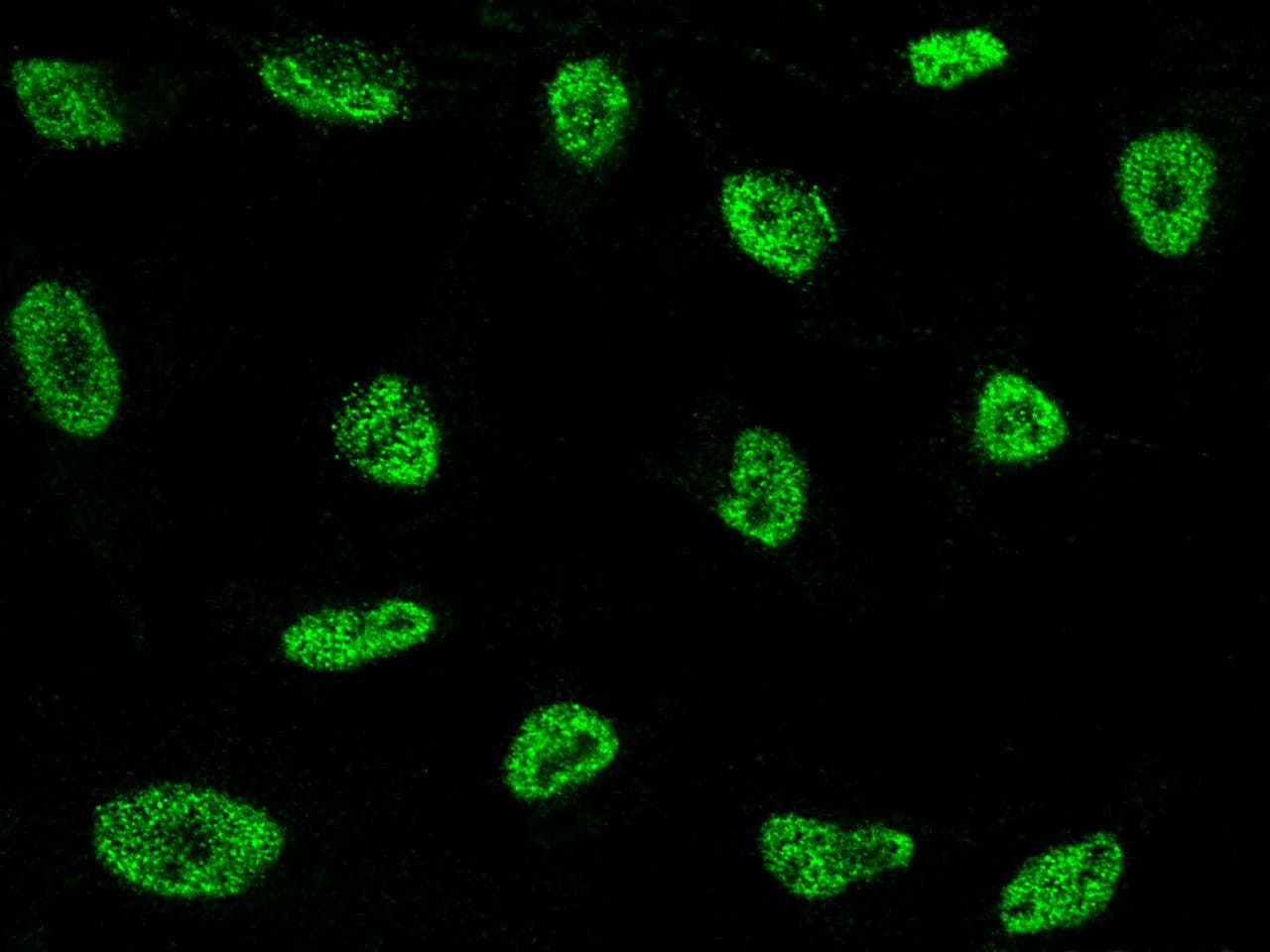 NCOR2 / SMRT Antibody (Preservative Free)