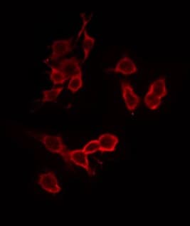 Polyclonal Rabbit anti-Human ATP5C1 Antibody (IF, WB)