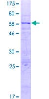 Human SLC25A42 Protein (Recombinant GST)