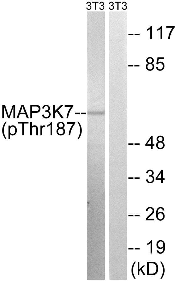 MAP3K7 / TAK1 Antibody (phospho-Thr187)