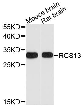Polyclonal Rabbit anti-Human RGS13 Antibody (WB)
