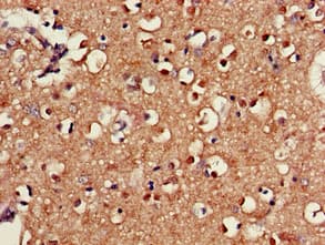SAMD8 Antibody