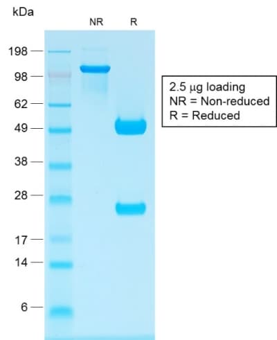 Recombinant Monoclonal Rabbit anti-Human IgG Heavy Chain Antibody (clone IG1707R, IHC)