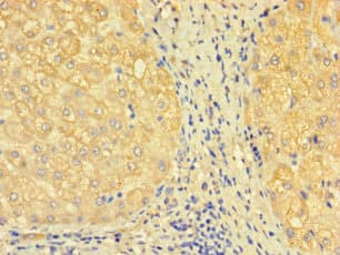 SDCBP2 / Syntenin 2 Antibody