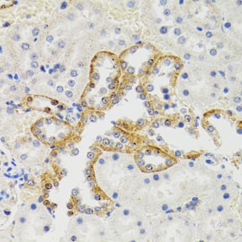 Polyclonal Rabbit anti-Human SH2B1 Antibody (IHC, IF, WB)