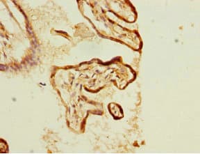 KLC1 / Kinesin Light Chain 1 Antibody