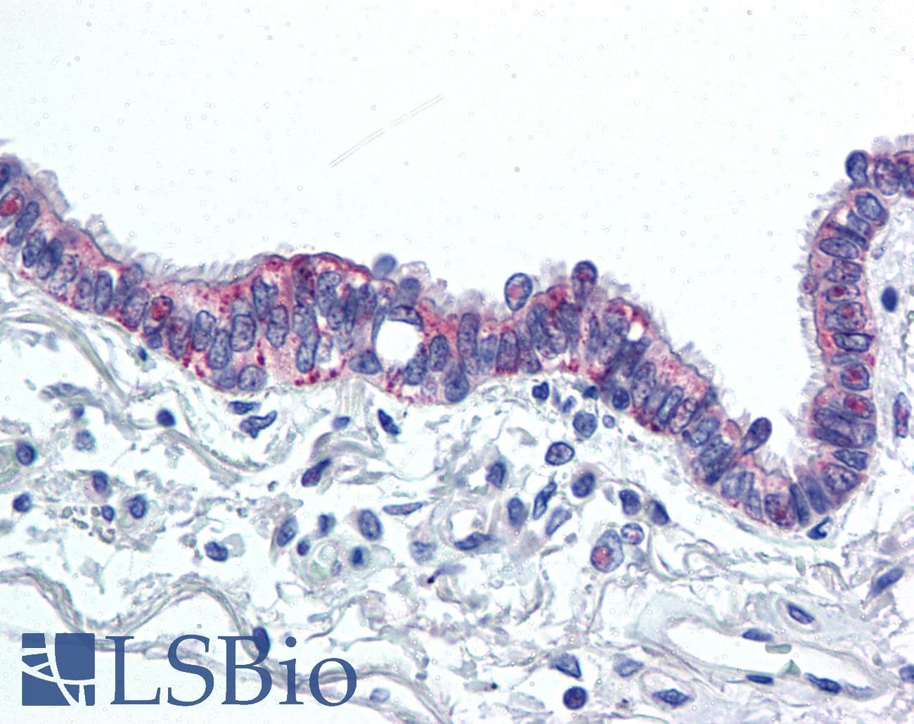 PathPlus™ IL6 / Interleukin 6 Antibody (Internal)