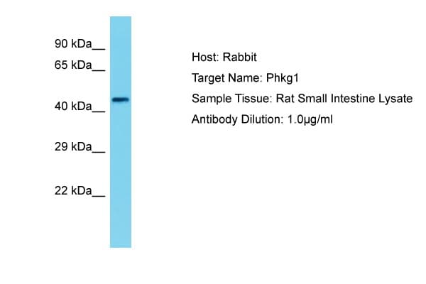 PHKG1 Antibody (N-Terminus)