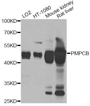 Polyclonal Rabbit anti-Human PMPCB / MPP11 Antibody (WB)