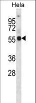Polyclonal Rabbit anti-Human KCNA1 / Kv1.1 Antibody (aa172-201, IHC, WB)
