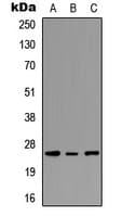 Polyclonal Rabbit anti-Human PEX11G Antibody (N-Terminus, IHC, WB)
