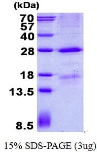 Human MBL2 / Mannose Binding Protein (Recombinant His)
