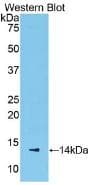Serum Amyloid A Antibody (aa20-122)