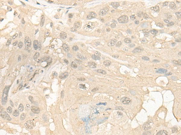 Polyclonal Rabbit anti-Human CYP4X1 Antibody (IHC)