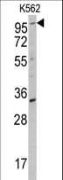 Polyclonal Rabbit anti-Human ROR2 Antibody (IHC, WB)