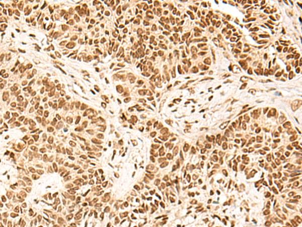 HOXC13 Antibody