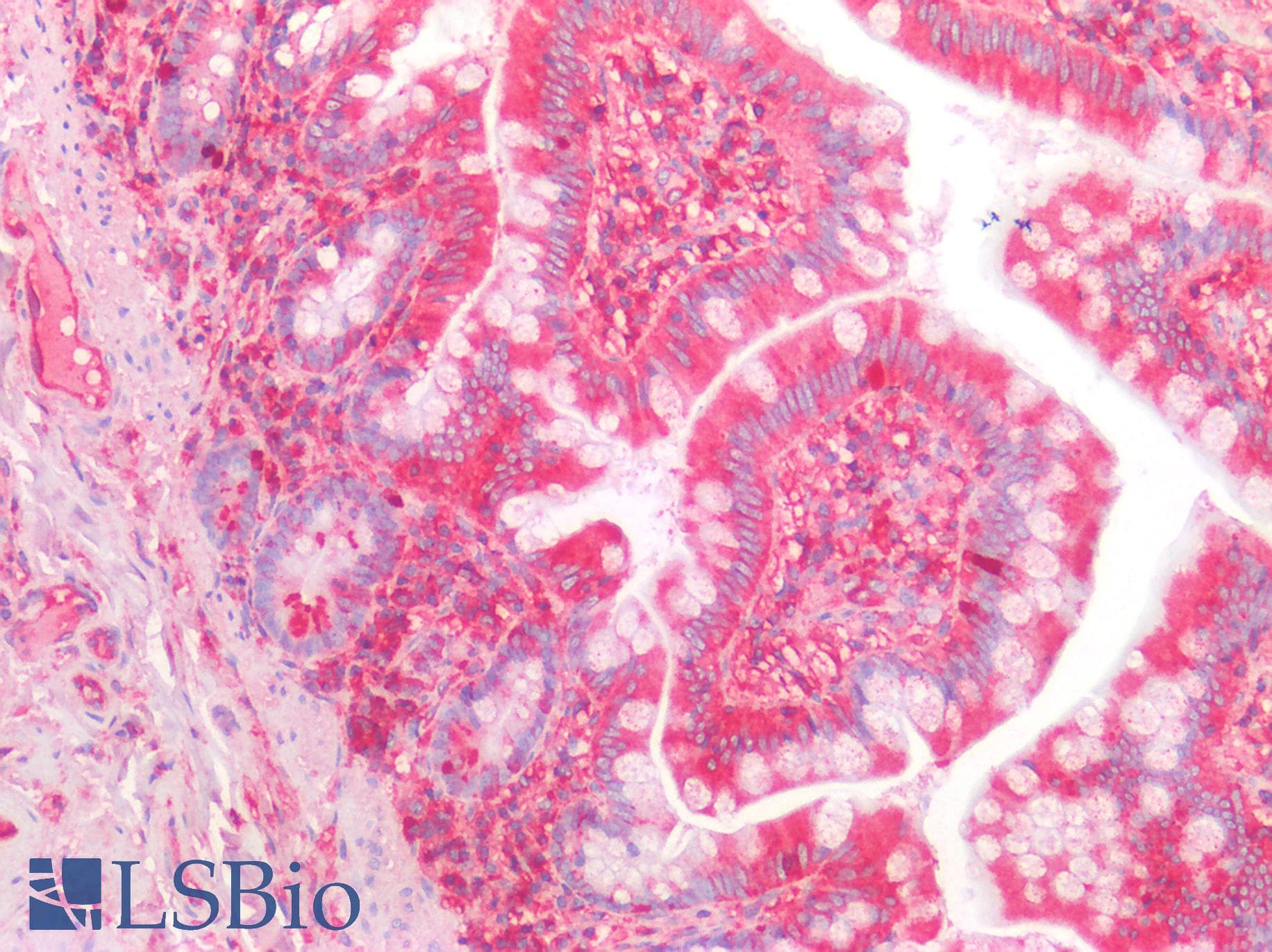 IHC-plus™ B2M / Beta 2 Microglobulin Antibody