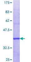 Human PLA2G6 / IPLA2 Protein (Recombinant GST, N-terminus)