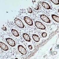 Monoclonal Mouse anti-Human HSP90AA1 / Hsp90 Alpha A1 Antibody (IHC, WB)