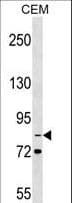 Polyclonal Rabbit anti-Human ITGB2 / CD18 Antibody (aa272-300, WB)