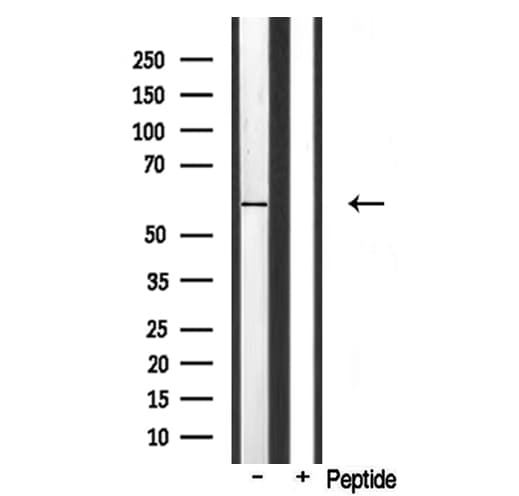 Polyclonal Rabbit anti-Human CYP1A2 Antibody (IHC, WB)