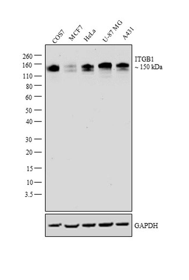 Monoclonal Mouse anti-Human ITGB1 / Integrin Beta 1 / CD29 Antibody (clone 3B6, IHC, WB)