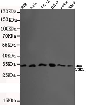 Monoclonal Mouse anti-Human CDK5 Antibody (WB)