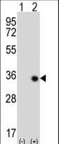 STK16 Antibody (aa257-286)