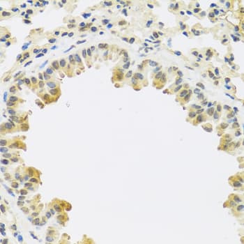 TGFB3 / TGF Beta3 Antibody