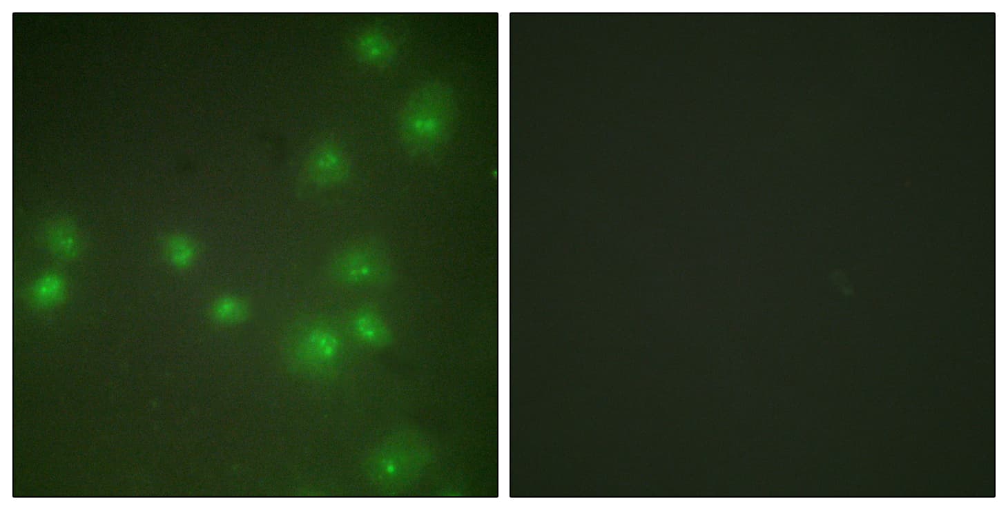 ZRANB2 / ZNF265 Antibody (aa106-155)