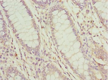 PDCD2L Antibody