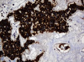 TSC22D1 / TSC22 Antibody (clone OTI2G3)