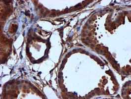 CYB5R3 / B5R Antibody (clone OTI1E8)