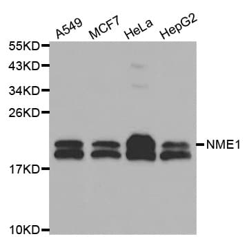 NME1 / NM23 Antibody