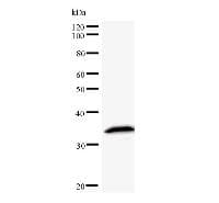 YARS / Tyrosyl-tRNA Synthetase Antibody (clone YAR5H08)