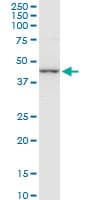 Monoclonal Mouse anti-Human CTH / Cystathionase Antibody (clone 4E1-1B7, WB)