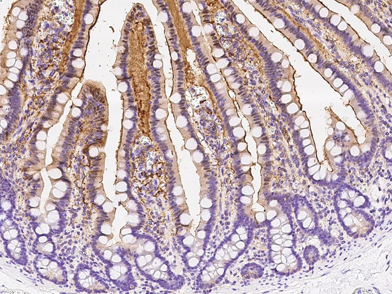 ADA / Adenosine Deaminase Antibody