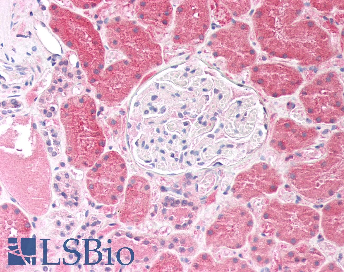 IHC-plus™ Polyclonal Rabbit anti-Human LAP3 Antibody (IHC, WB)